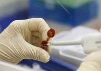 Domuz gribinden ölenlerin sayısı artıyor