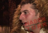 Fırat Altunmeşe sevgilisi tarafından darp edildi