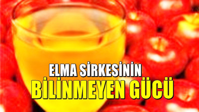 Elma sirkesinin 5 farklı kullanım alanı: Çoğu kişi sadece salataya ekliyordu...