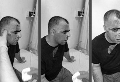 Gazeteci Sinan Aygül’e saldırı olayında yeni gelişme