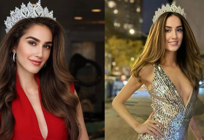 Miss Turkey birincisi İdil Bilgen'in son hali tartışma yarattı
