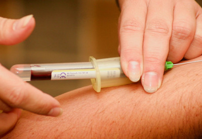 Türkiye bu haberi konuşuyor: 13 yaşındaki erkek çocuğu AIDS'ten öldü