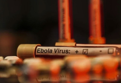 ABD'den Ebola uyarısı: Tarihin en ölümcül seviyesine ulaşabilir