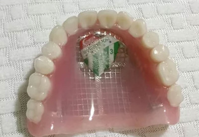 Görenler şoke oluyor, böyle taraftar görülmedi! Damağına Bursaspor arması yaptırdı