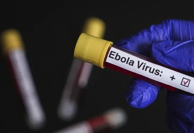 Kongo'da Ebola salgını: Can kaybı artıyor