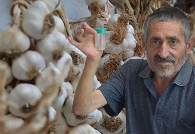 Doktorları bile şaşırtan olay! Nefes darlığı şikayetiyle gitti, akciğerinden sarımsak çıktı