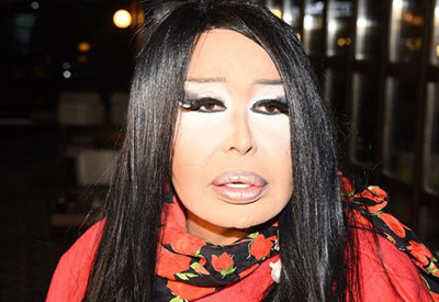 Bülent Ersoy yoğun bakıma kaldırıldı!