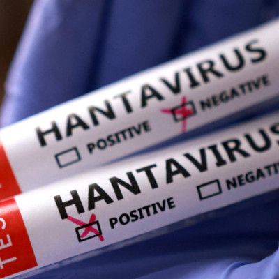 Hantavirüs kabusu büyüyor! ABD'ye de sıçradı; 6 ülke alarma geçti