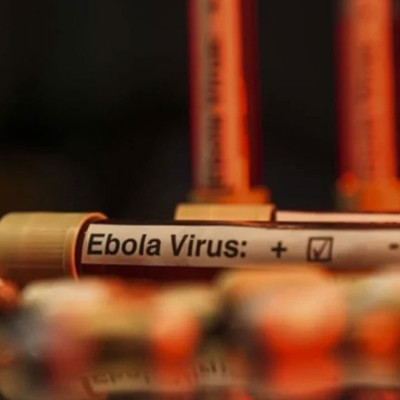 ABD'den Ebola uyarısı: Tarihin en ölümcül seviyesine ulaşabilir