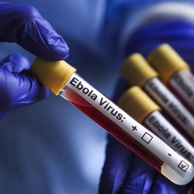 Orta Doğu ülkesinde Ebola alarmı! Git gide yaklaşıyor