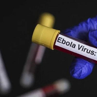 Kongo'da Ebola salgını: Can kaybı artıyor