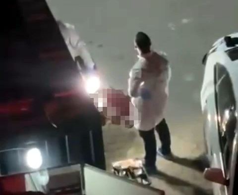 Avcılar'da araç satışı sırasında silahlı kavga - Resim: 2