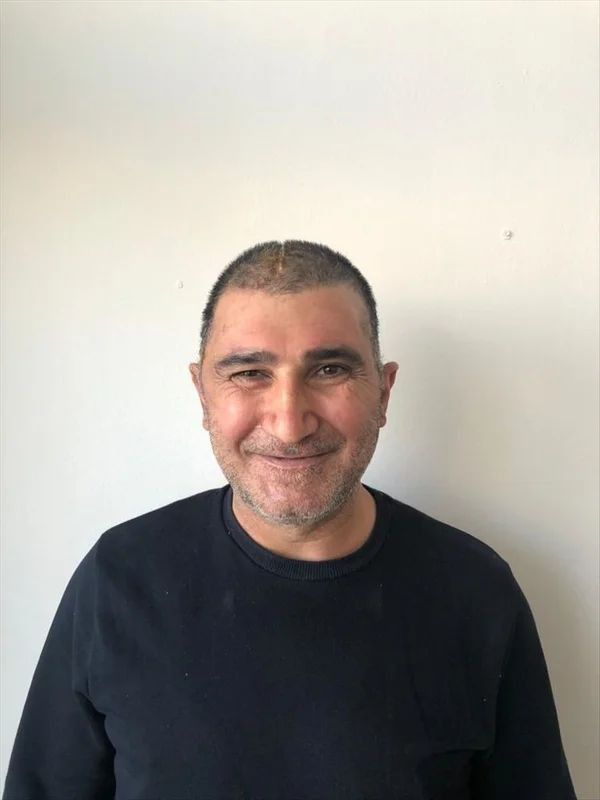 Kafatasının yüzde 83'ü parçalanmıştı! Titanyum parçalarıyla eski görüntüsüne kavuştu - Resim: 3