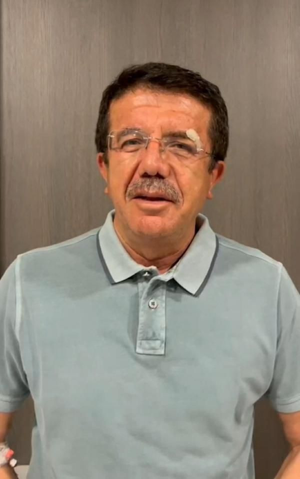 Kazada yaralanan eski Bakan Zeybekci, taburcu oldu - Resim : 1