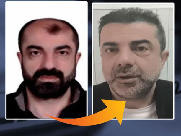 Ankara'da film gibi olay: Ameliyatla yüzünü değiştirip saç ektiren cinayet zanlısı yedi yıl sonra yakalandı