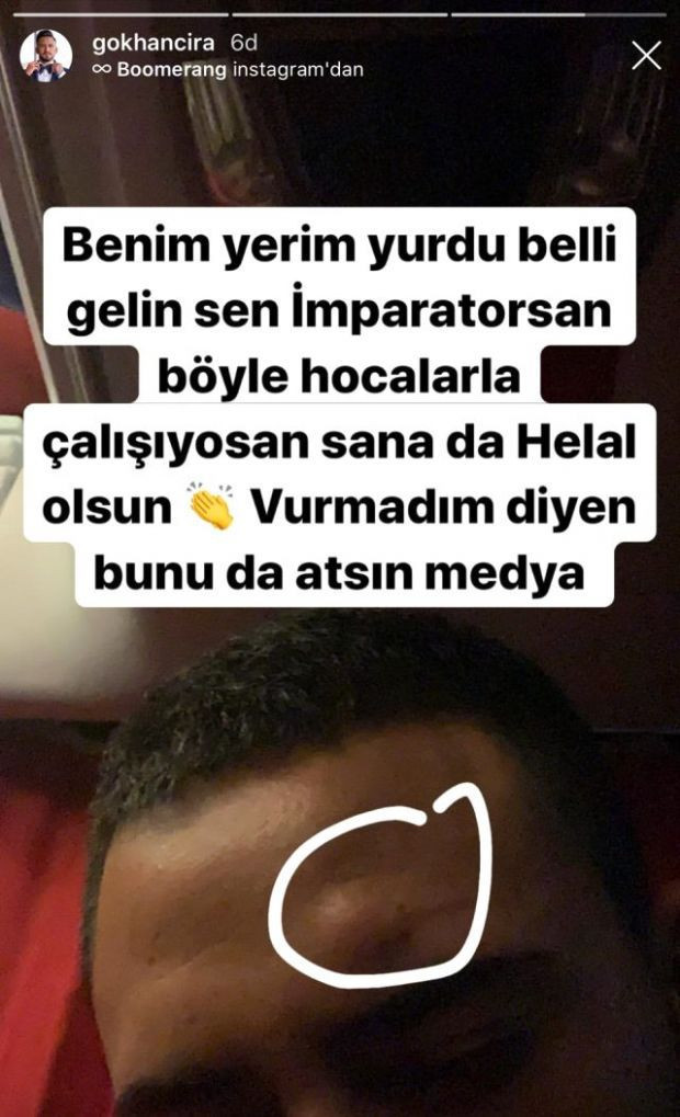 İşte kavga sonrası Gökhan Çıra'nın son hali! - Resim : 2