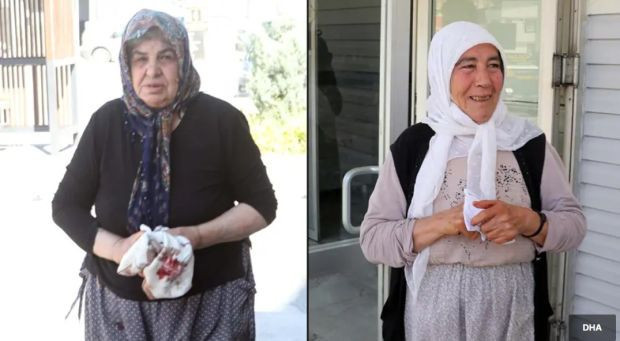 İstanbul'da bayramın ilk gününde 767 kişi hastanelere başvurdu - Resim : 3