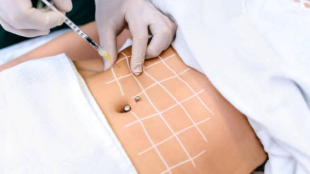 Zayıflamak için gittiler mide botoksundan zehirlendiler! Obezite ve enfeksiyon dernekleri alarmda - Resim : 1