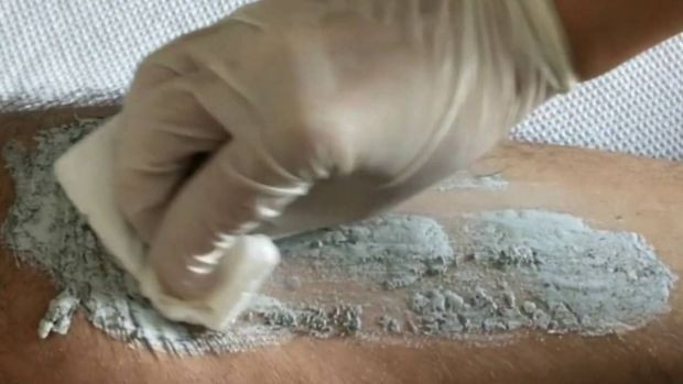 İstenmeyen tüyleri kökten bitiren doğal yöntem. Osmanlı’dan beri kullanılıyor! - Resim : 1