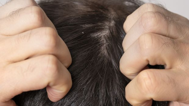 Doğal şifa kürü: Doğru uygulanınca egzamayı bitiriyor. - Resim : 2