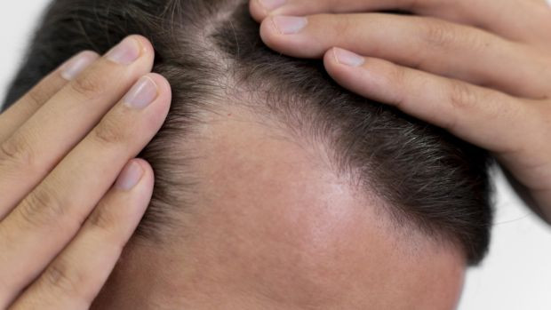 Doğal şifa kürü: Doğru uygulanınca egzamayı bitiriyor. - Resim : 4