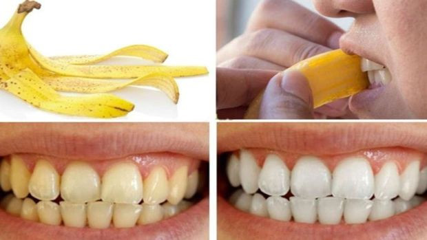 Çöpe atanlar bir daha düşünsün! Hekimler faydasını açıkladı. Duyan pişman oluyor - Resim : 1