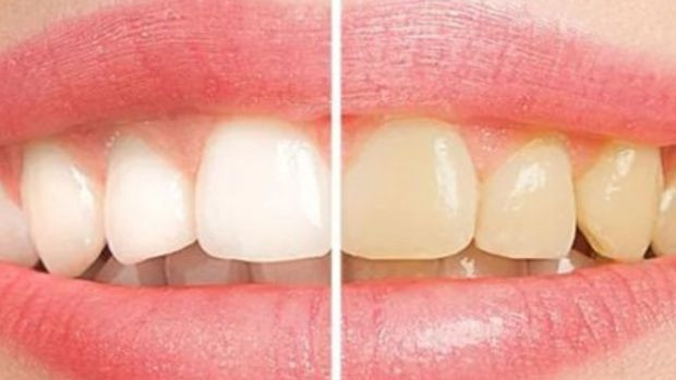 Çay demlerken acısını almanın püf noktası: 1 tatlı kaşığı eklemek yetiyor - Resim : 4