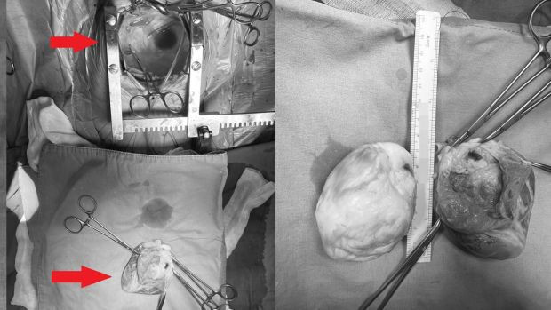 Bu bir tıp mucizesi... Hiç kimse yaşam şansı vermiyordu - Resim : 1