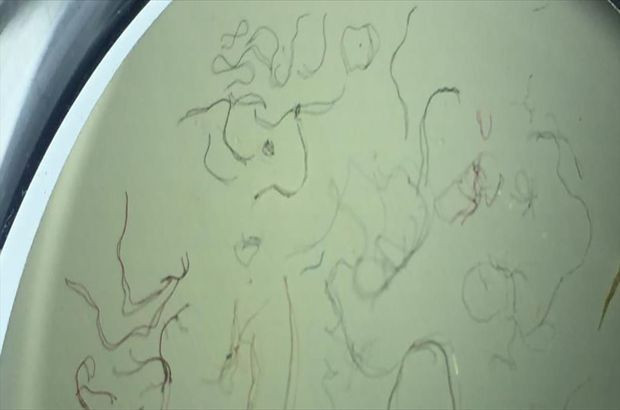 İzmit Körfezi'ndeki her 10 balıktan 4'ünde mikroplastik tespit edildi - Resim : 3