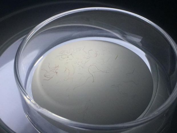 İzmit Körfezi'ndeki her 10 balıktan 4'ünde mikroplastik tespit edildi - Resim : 2