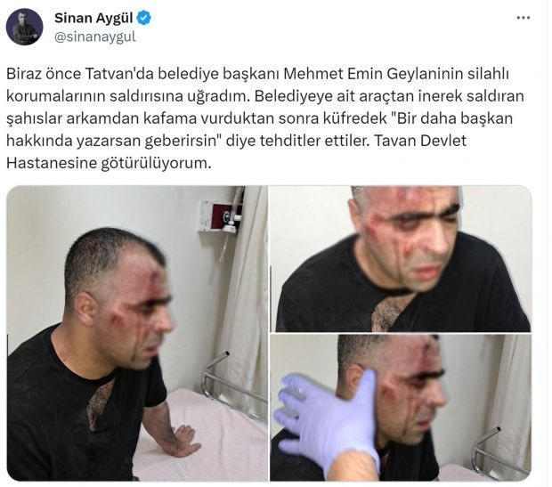 Gazeteci Sinan Aygül'e öldüresiye dayak! Tatvan Belediye Başkanı Geylani'den açıklama - Resim : 1