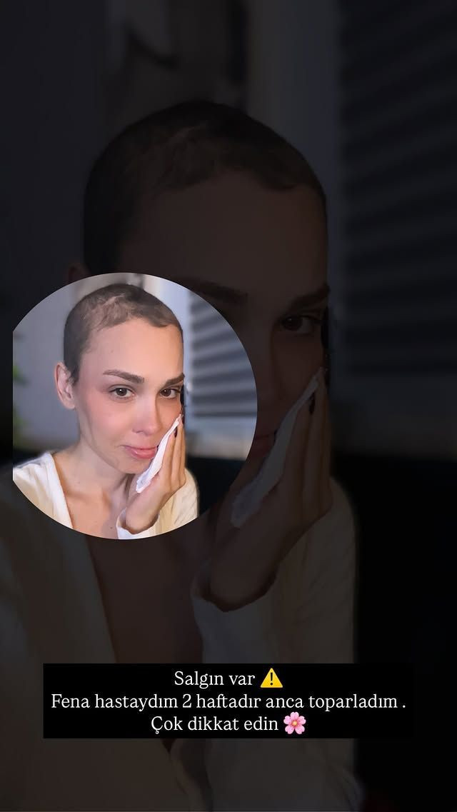 Kanseri yenmişti! Şimal'in son hali yine üzdü - Resim: 3