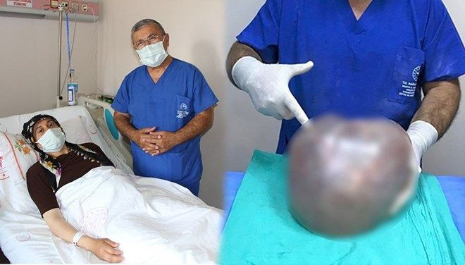 Fazla kilo zannediyordu: Karnından çıktı! 6,4 kilo... - Resim: 4