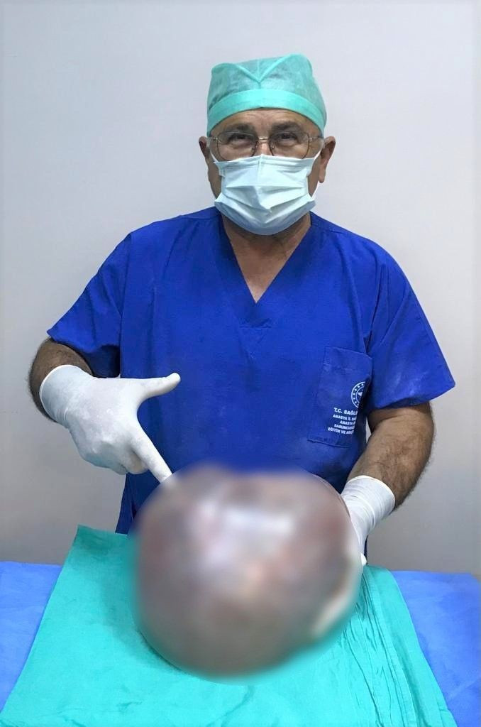 Fazla kilo zannediyordu: Karnından çıktı! 6,4 kilo... - Resim: 1