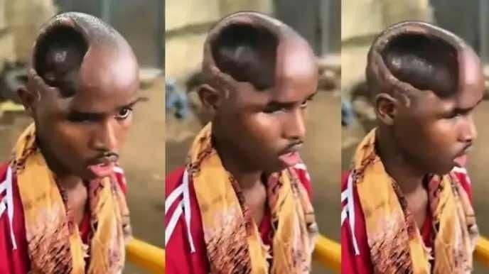 Sağlık dünyası şokta! Beyni olmadan yaşıyor! - Resim: 1