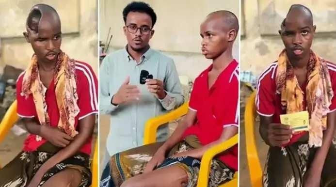 Sağlık dünyası şokta! Beyni olmadan yaşıyor! - Resim: 2