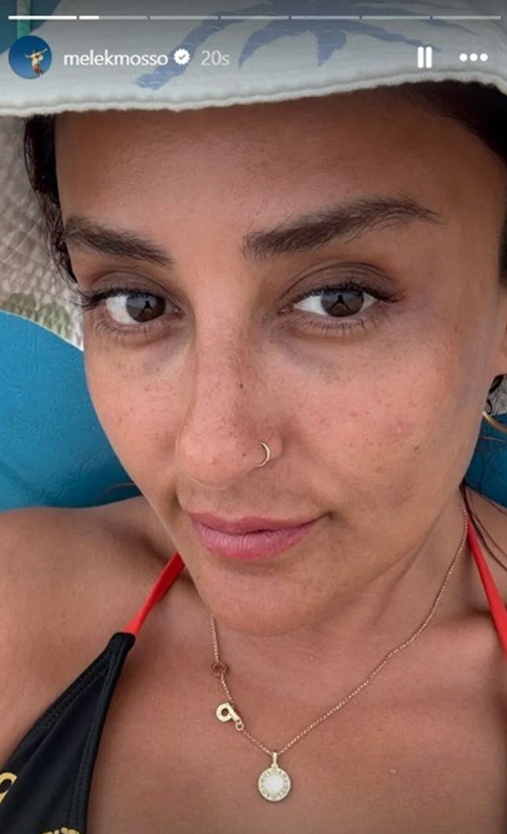 Melek Mosso isyan etti! Makyajsız halini yerden yere vurdular - Resim: 2