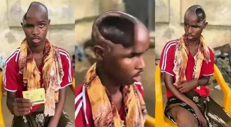 Sağlık dünyası şokta! Beyni olmadan yaşıyor! - Resim: 4