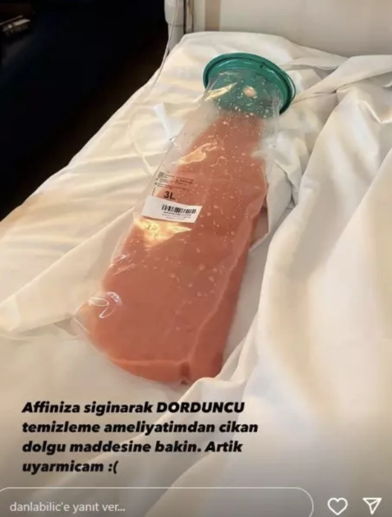 Danla Bilic'in kalçasından çıkana bakın! Dolgu maddesi ağızları açık bıraktı - Resim: 4