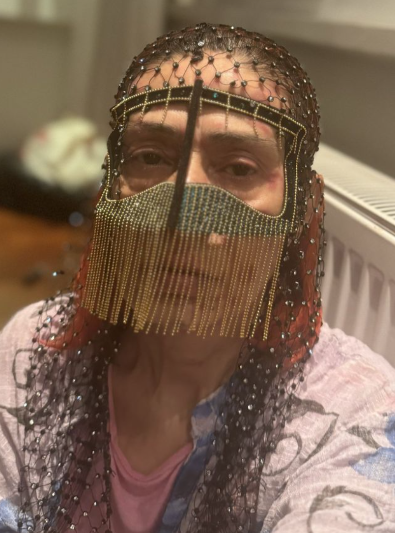 Yıldız Tilbe'nin yüzü yandı! Çareyi maske takmakta buldu - Resim: 3