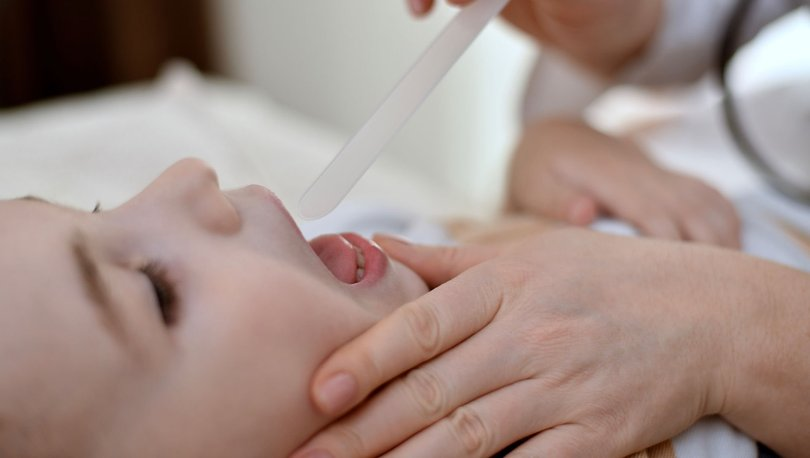 Strep A tam anlamıyla nedir, nasıl bulaşır? Strep A belirtileri, teşhis ve tedavisi... - Resim: 3