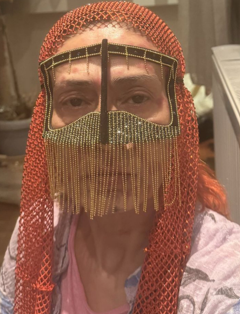 Yıldız Tilbe'nin yüzü yandı! Çareyi maske takmakta buldu - Fotoğraf: 4