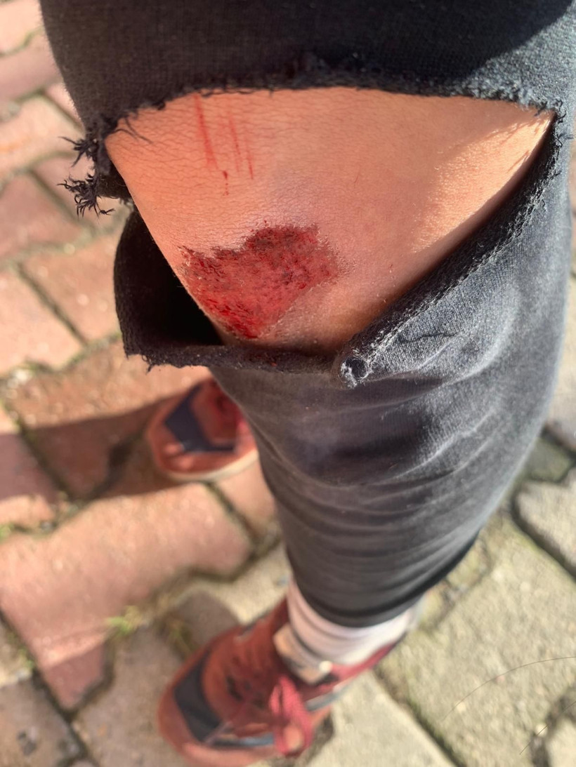 Ataşehir’de CAN TV muhabirine komşularından saldırı: “Yoldan geçenler olmasa beni öldüreceklerdi” - Resim: 3