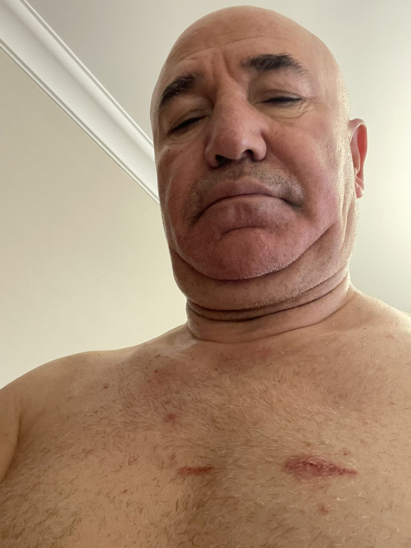 Mahmut Tanal vücudundaki darp izlerini paylaştı: “Hukuk devleti yaralandı” - Resim: 2