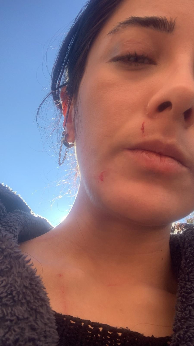 Ataşehir’de CAN TV muhabirine komşularından saldırı: “Yoldan geçenler olmasa beni öldüreceklerdi” - Resim: 2