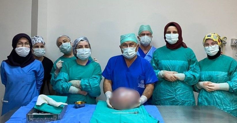 Fazla kilo zannediyordu: Karnından çıktı! 6,4 kilo... - Resim: 2
