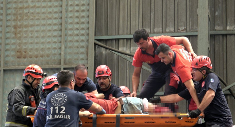Plastik fabrikasında feci olay! İki bacağı, diz altından koptu! - Resim: 2