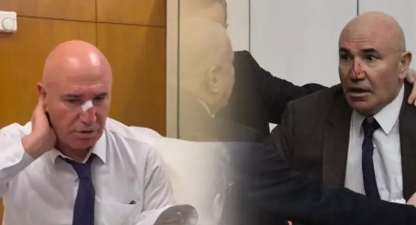 Meclis'teki yumruklu kavgada CHP'li Tanal'ın burnu kanadı! İlk müdahale revirde yapıldı - Resim: 1