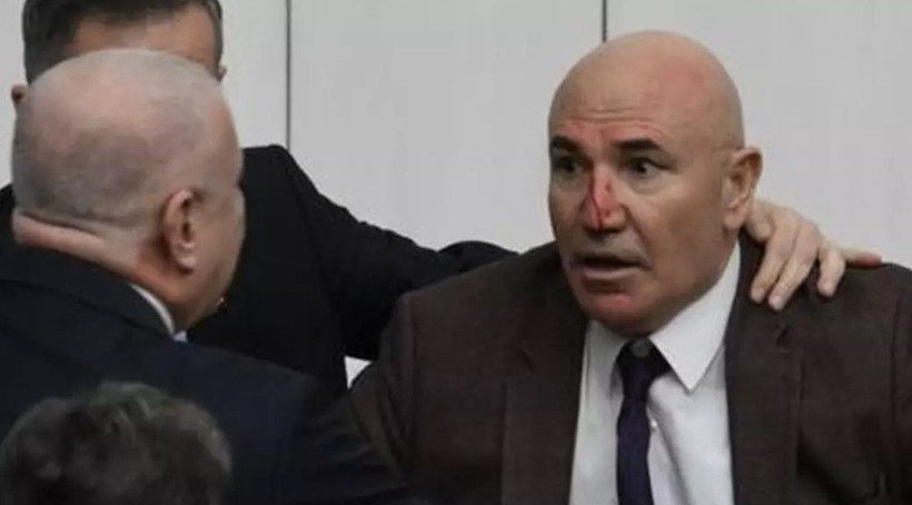 Meclis'teki yumruklu kavgada CHP'li Tanal'ın burnu kanadı! İlk müdahale revirde yapıldı - Resim: 3