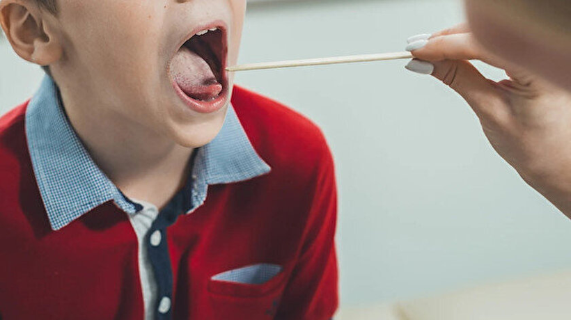 Strep A tam anlamıyla nedir, nasıl bulaşır? Strep A belirtileri, teşhis ve tedavisi... - Resim: 1